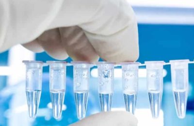 PCR test