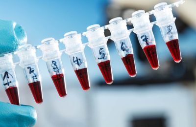 pcr test sonucu