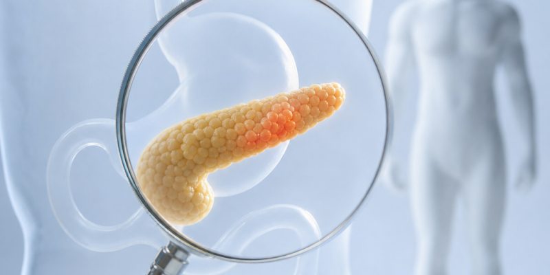 Pankreas Kanseri Neden Bu Kadar Sinsi Bir Hastalık Nasıl Erken Adım Atılır?