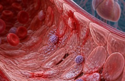 Damar İç Yüzeyindeki Sessiz Tehdit Endotelyal Disfonksiyonun Klinik Etkileri