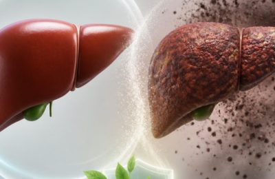 Sessizce Yıpranan Karaciğeriniz İçin Alarm Zilleri Çalıyor Olabilir mi?
